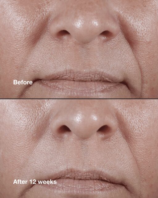 Clinique Smart Clinical Repair™ Wrinkle Correcting Rich Cream - Image 2
