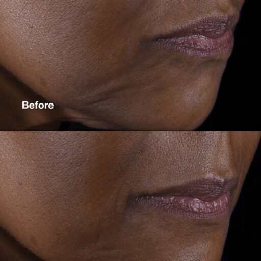Clinique Smart Clinical Repair Lifting Face+Neck Cream - Image 2