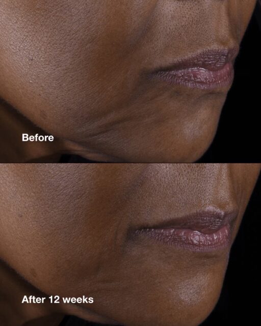 Clinique Smart Clinical Repair Lifting Face+Neck Cream - Image 2