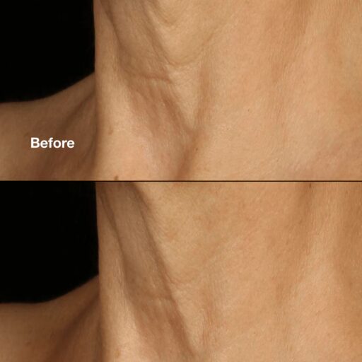 Clinique Smart Clinical Repair Lifting Face+Neck Cream - Image 3