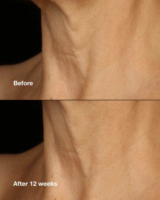 Clinique Smart Clinical Repair Lifting Face+Neck Cream - Image 3
