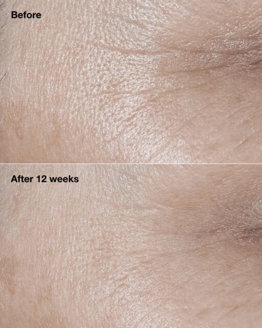 Clinique Smart Clinical Repair™ Broad Spectrum SPF 30 Wrinkle Correcting Cream - Image 2