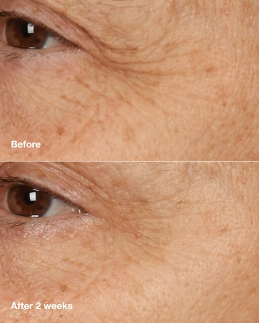 Clinique Smart Clinical Repair™ Overnight Recovery Cream + Mask - Image 3