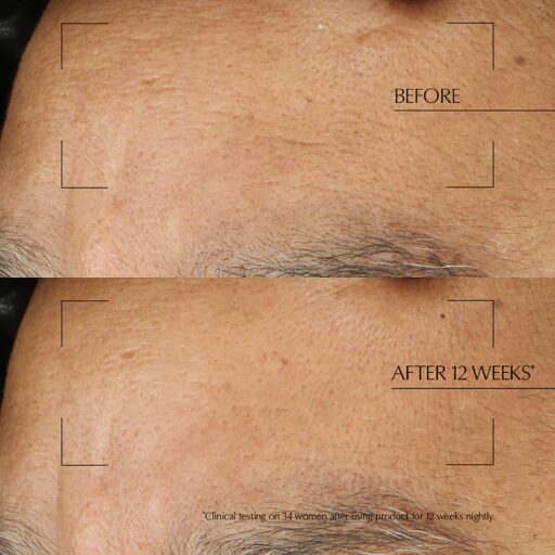 Estee Lauder Advanced Night Repair Overnight Treatment - Image 6